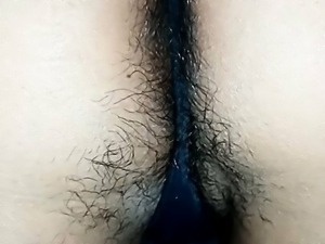 Hairy Anal Tubes